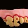 Плохие накладные зубы для селфи - Плохие накладные зубы для селфи